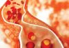 Myths about cholesterol continue to rule the minds