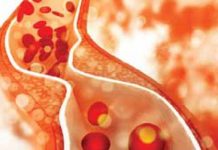 Myths about cholesterol continue to rule the minds